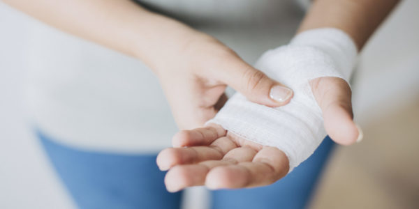 Woman with gauze bandage wrapped around her hand